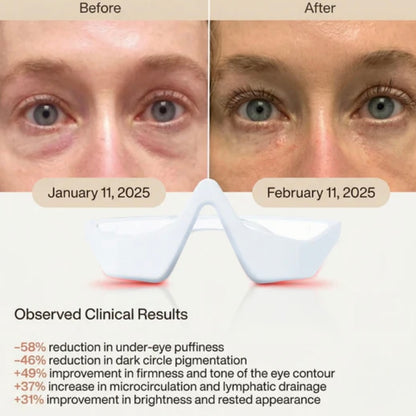 VisionEase™ 3D Oogmassage‑Bril