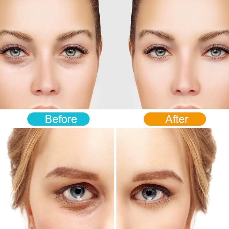 VisionEase™ 3D Oogmassage‑Bril